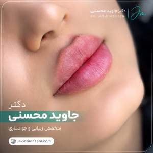 تزریق ژل لب