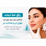 رفع خط لبخند