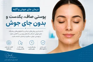 درمان جای جوش و آکنه