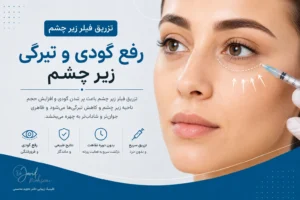 فیلر زیر چشم