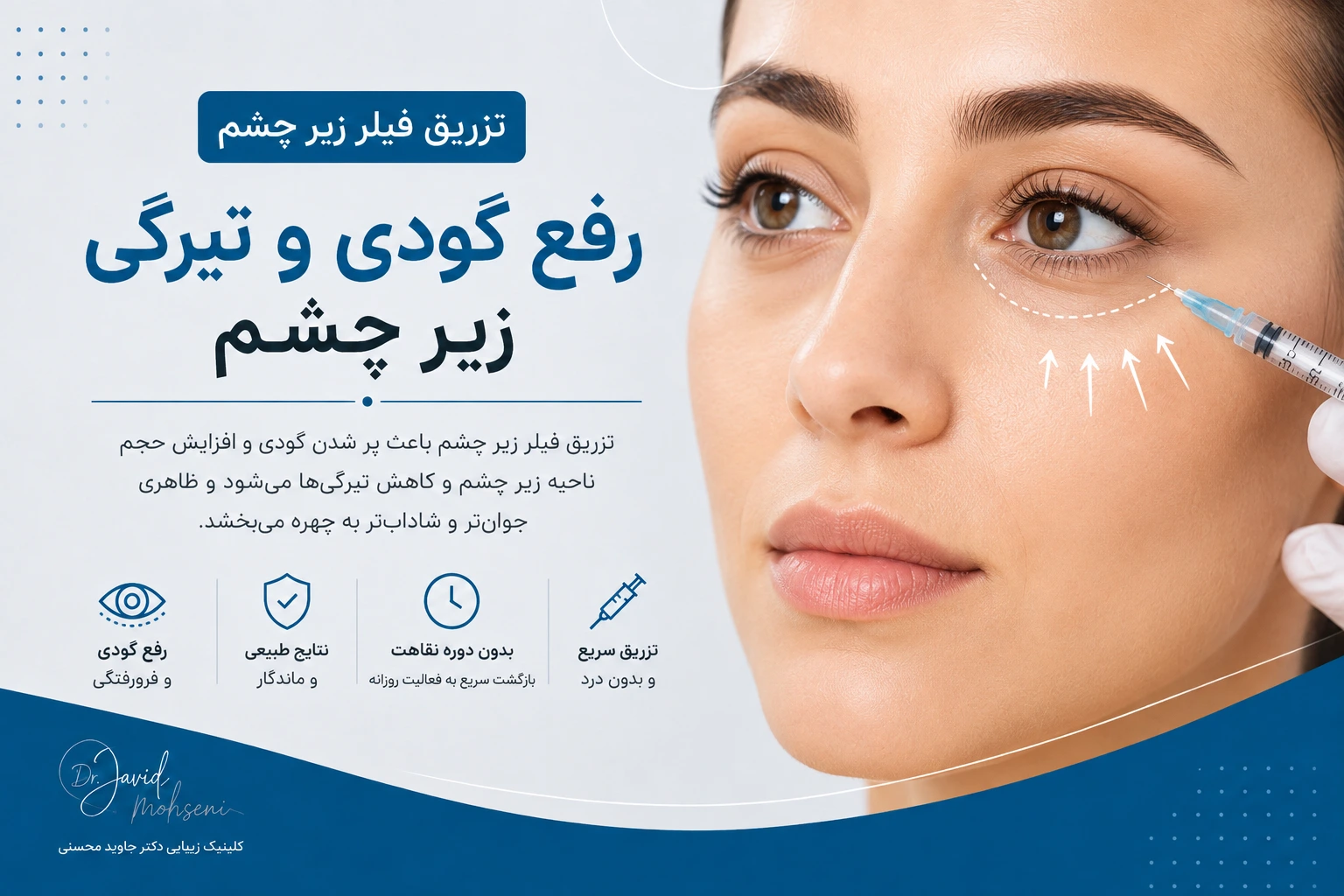 فیلر زیر چشم